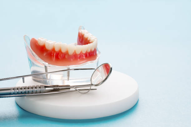 Dental Bonding in La Mesa, CA